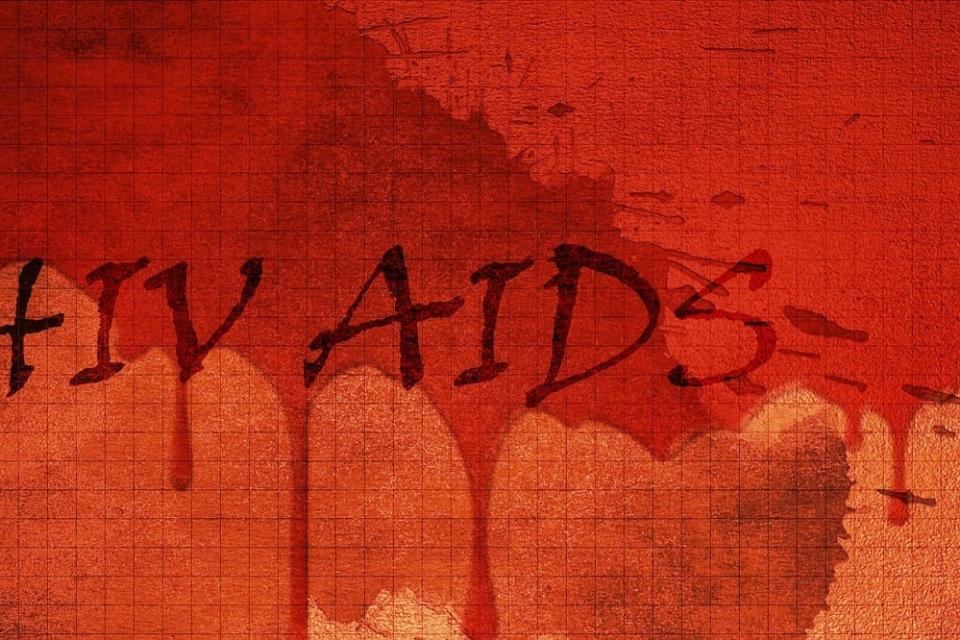 HIV AIDS