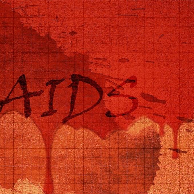 HIV AIDS